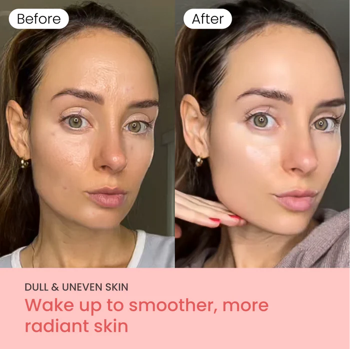 Décolletage firming
