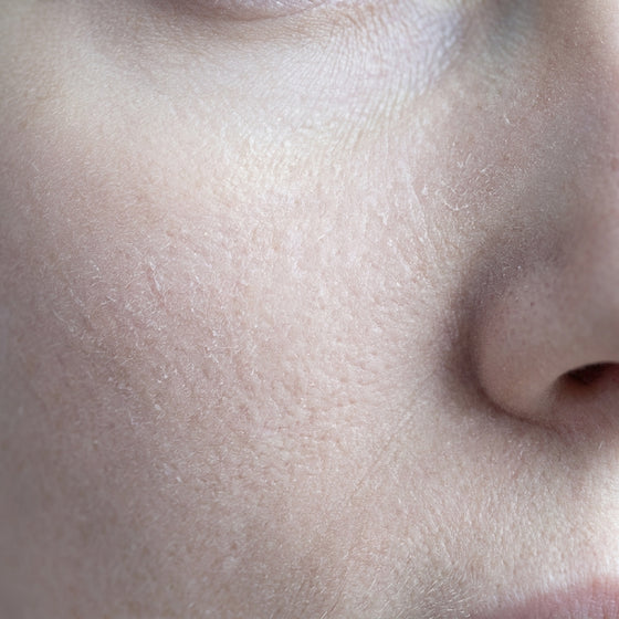 A weakened skin barrier