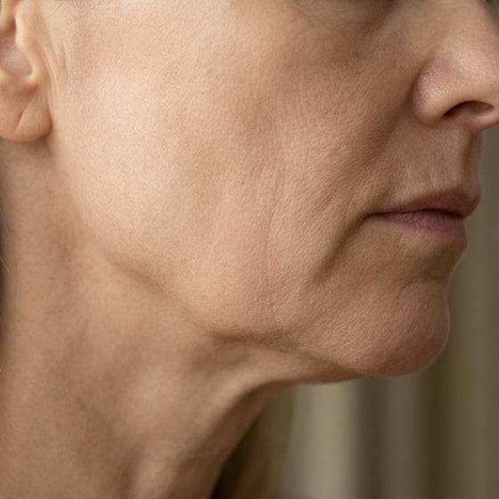 Fine lines deepening overnight
